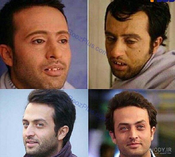 بازیگران چوکوروا
