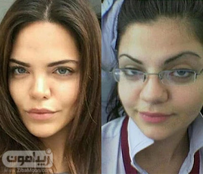 عکس قبل عمل زلیخا بازیگر ترک