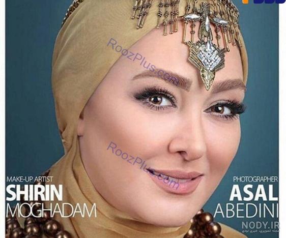 عکس قبل عمل زلیخا در چوکوروا