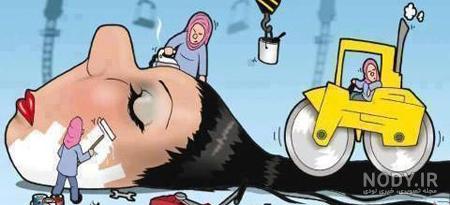 کاشت ناخن ساده