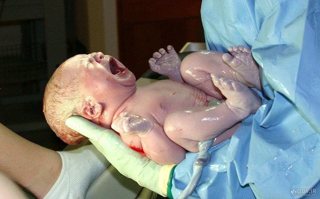 عکس نوزاد تازه متولد شده