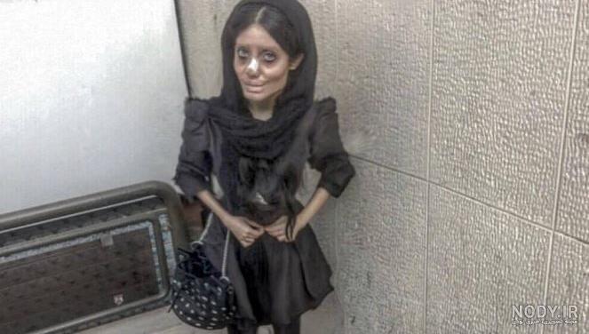 عکس سحر تبر قبل از عمل عکس سحر تبر قبل از عمل