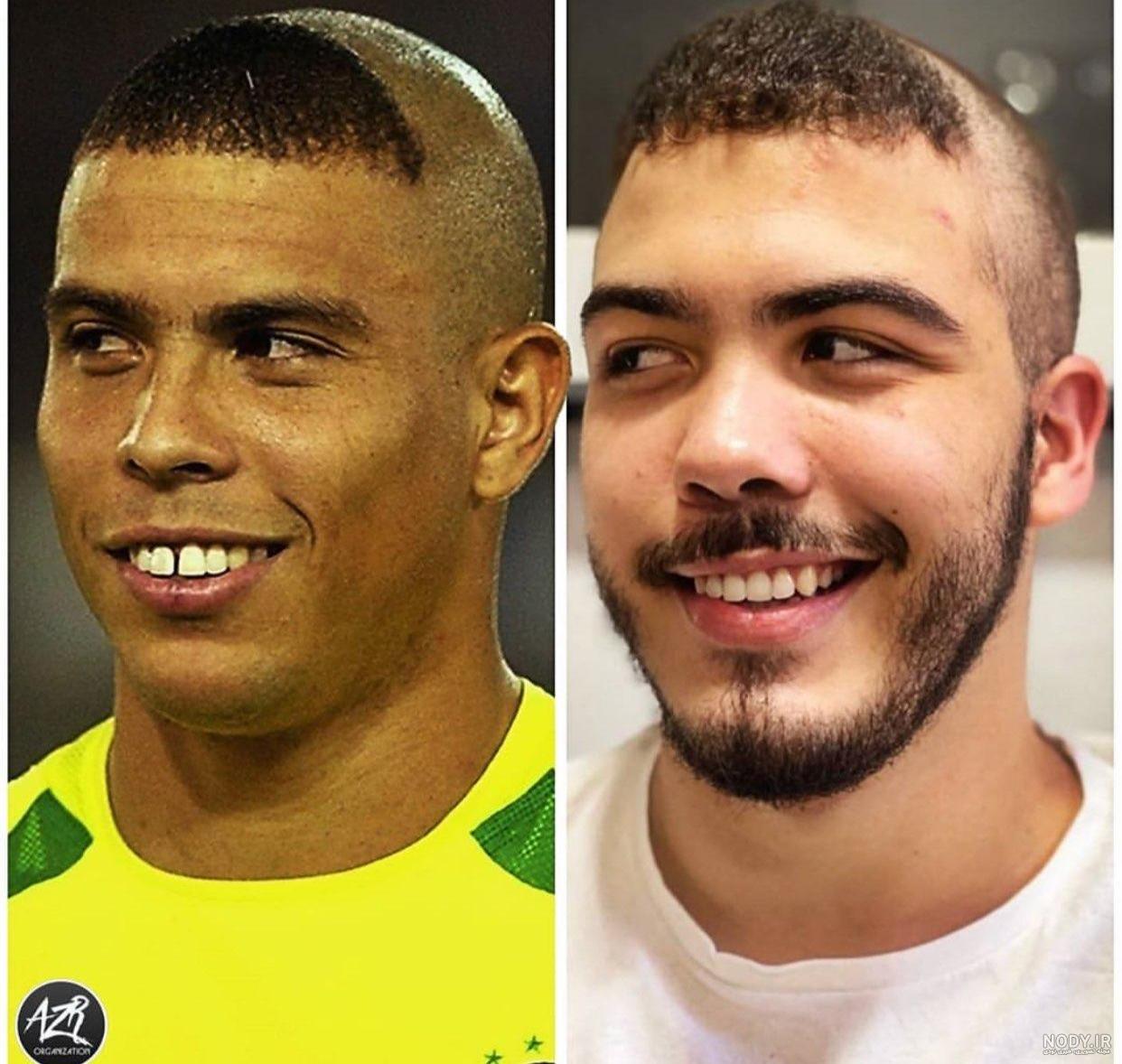 رونالدو کچل کرد
