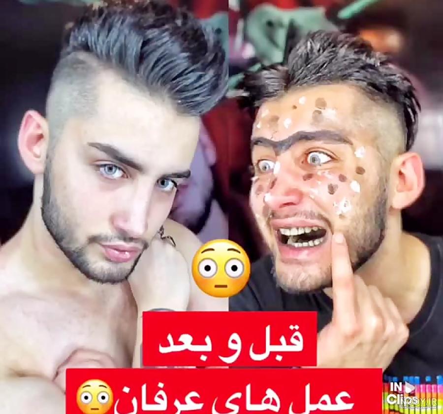 دانلود آهنگ عرفان فاتح چشم تو چشم دانلود آهنگ عرفان فاتح چشم تو چشم