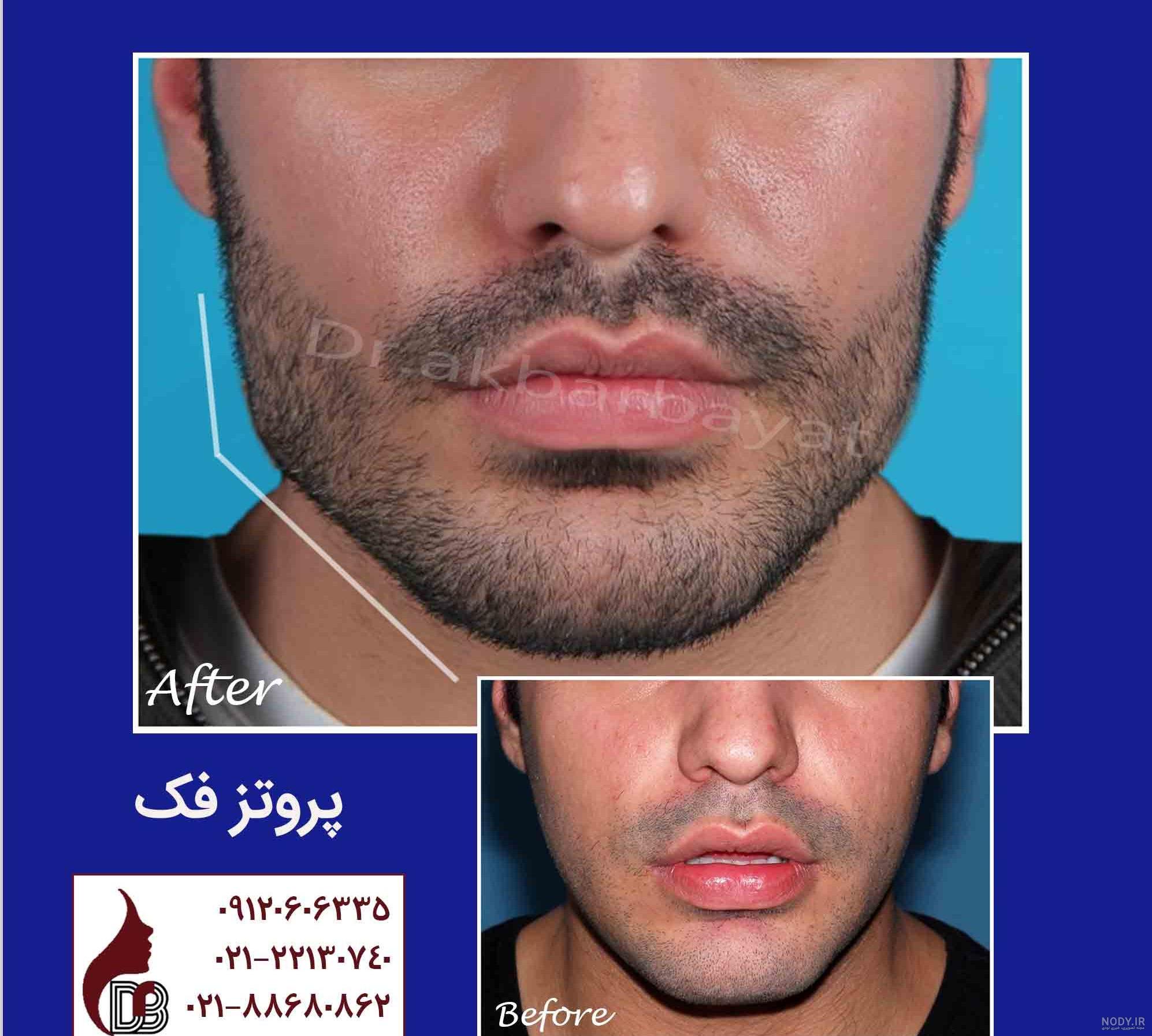 دانلود اهنگ عرفان فاتح عروسک دانلود اهنگ عرفان فاتح عروسک