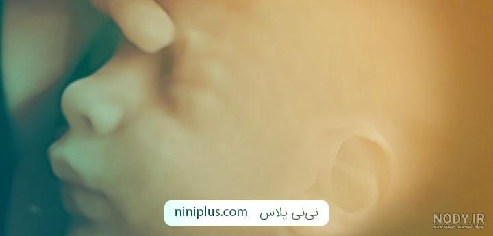 قیمت سونوگرافی سه بعدی