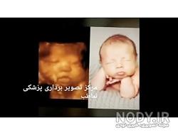 قیمت سونوگرافی سه بعدی در سال ۹۹