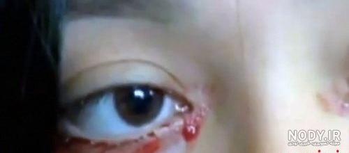 چگونه خون گریه کنیم چگونه خون گریه کنیم