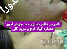 تبادل نظر در مورد صابون مریم گلی