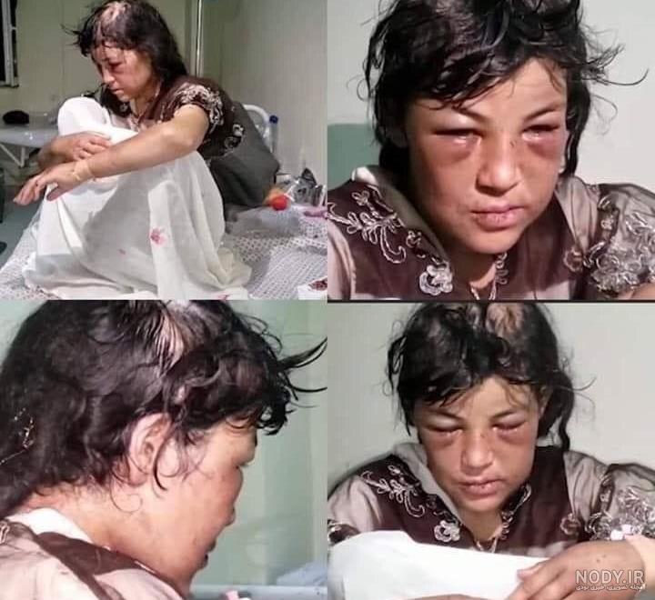 عکس بچه دوم زلیخا و دمیر