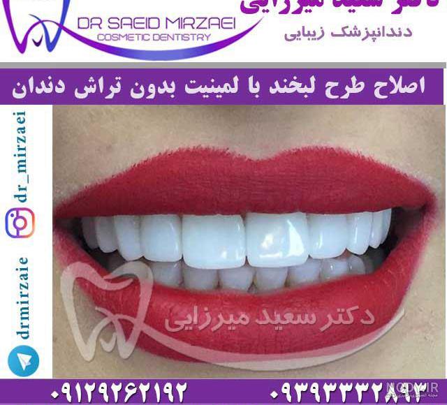 بهترین دکتر برای اصلاح طرح لبخند