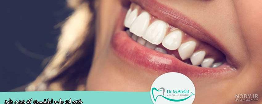 طرح لبخند چیست طرح لبخند چیست