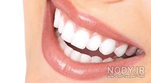 عوارض لمینت دندان عوارض لمینت دندان