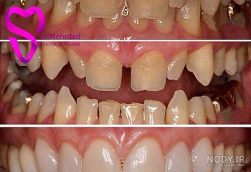 عکس طرح لبخند عکس طرح لبخند