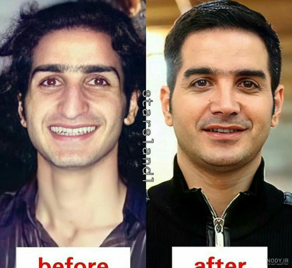 عکس محسن یگانه قبل و بعد