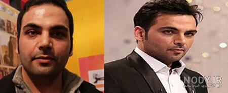 عکس مراحل رشد مو بعد از کاشت عکس مراحل رشد مو بعد از کاشت