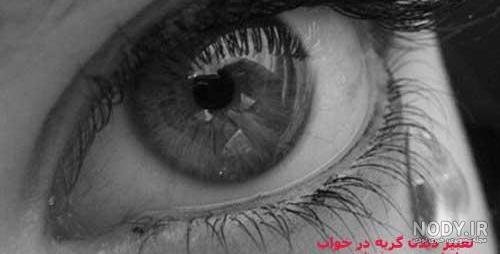عکس چشم خونی