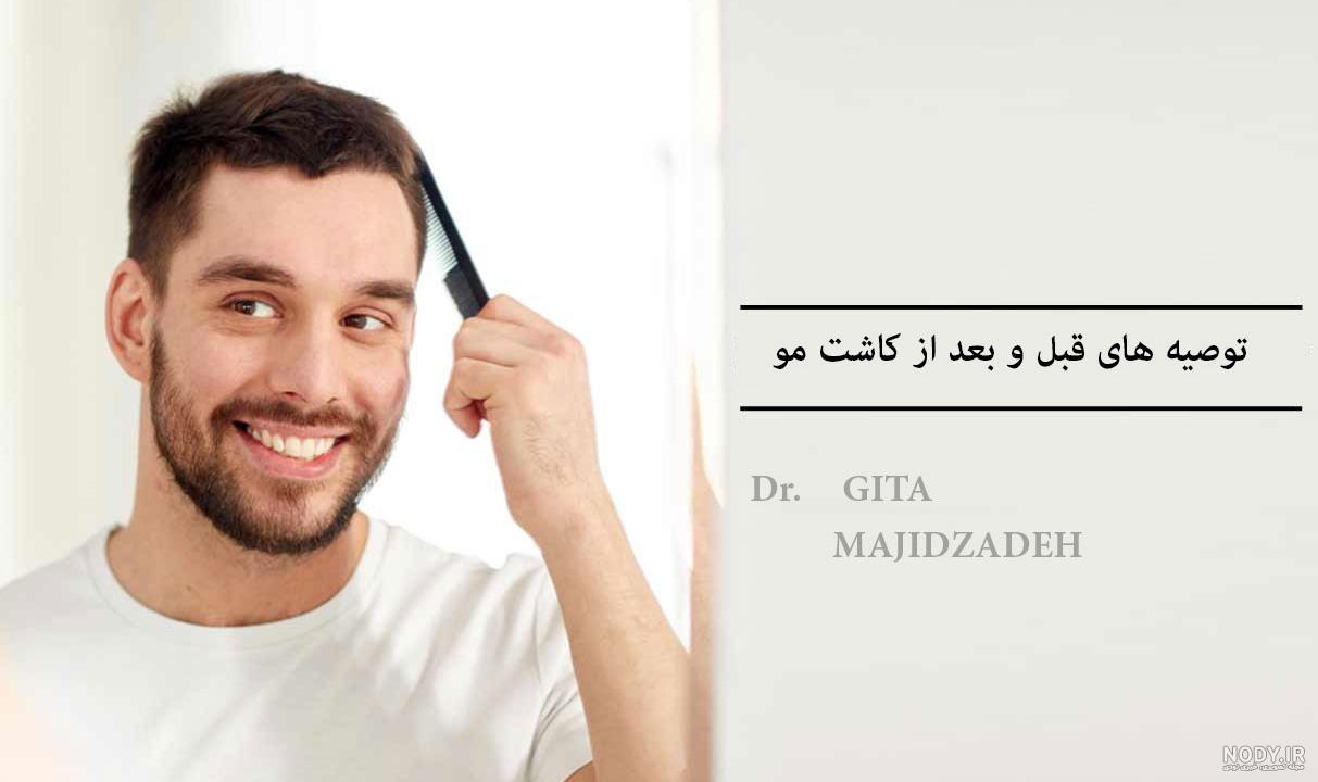 فیلم مراحل کاشت مو فیلم مراحل کاشت مو