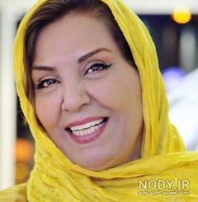 زهره حمیدی بعد از عمل