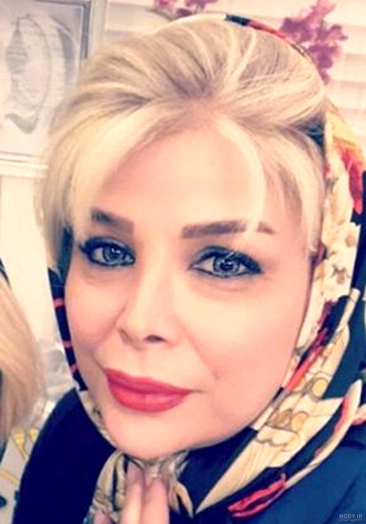بیماری شیوا خنیاگر چیست بیماری شیوا خنیاگر چیست