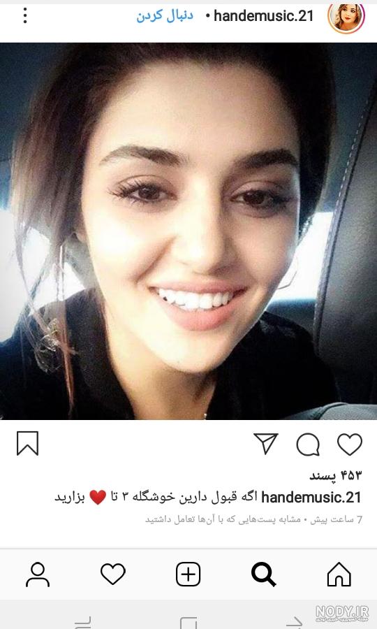 سگ های هانده ارچل