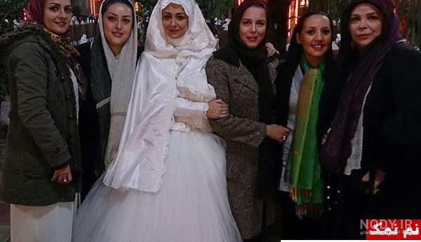 شیوا خنیاگر قبل از عمل بینی شیوا خنیاگر قبل از عمل بینی