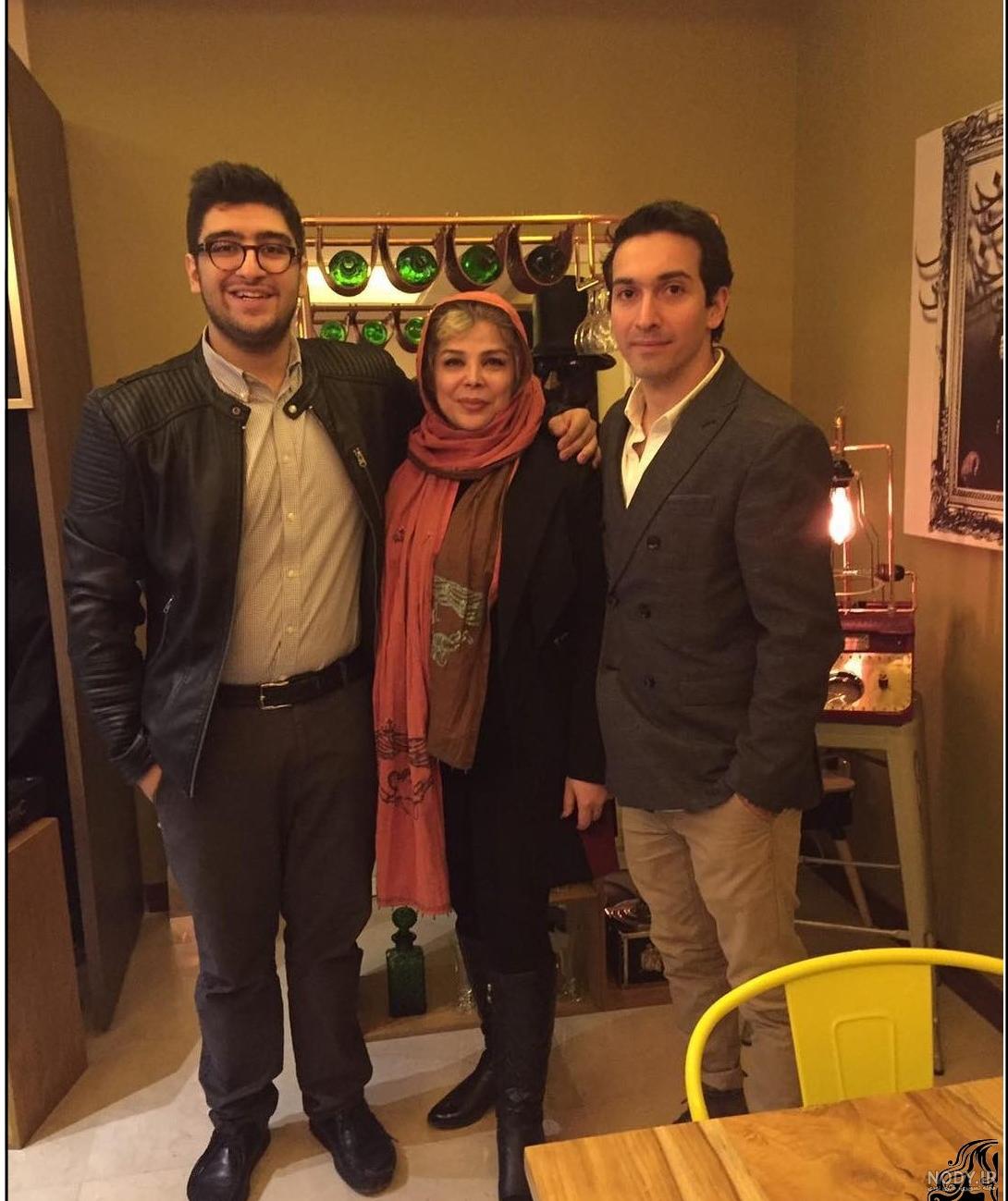 شیوا خنیاگر قبل از عمل بینی شیوا خنیاگر قبل از عمل بینی