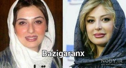عکس قبل وبعدازعمل نیوشا ضیغمی عکس قبل وبعدازعمل نیوشا ضیغمی