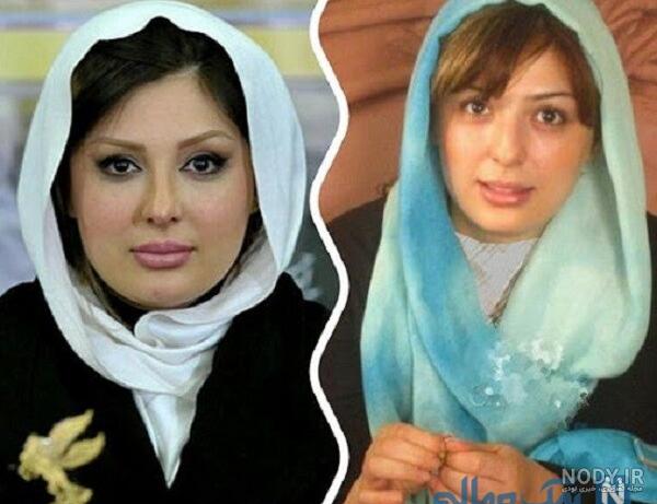 قیافه ی زشت نیوشا ضیغمی بعد از عمل دوم بینی قیافه ی زشت نیوشا ضیغمی بعد از عمل دوم بینی