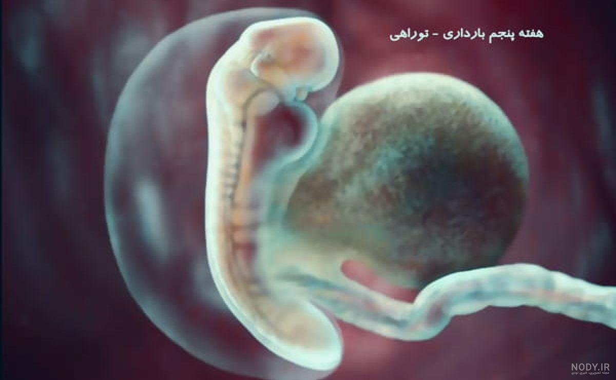 لکه بینی و جنسیت جنین نی نی سایت