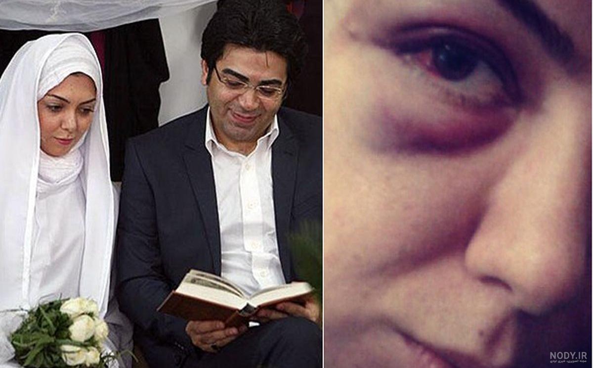 عکس همسر اول فرزاد حسنی