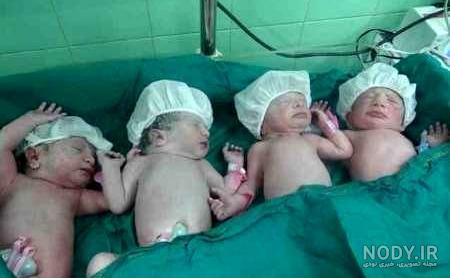 کیا با میکرو دوقلو باردار شدن کیا با میکرو دوقلو باردار شدن