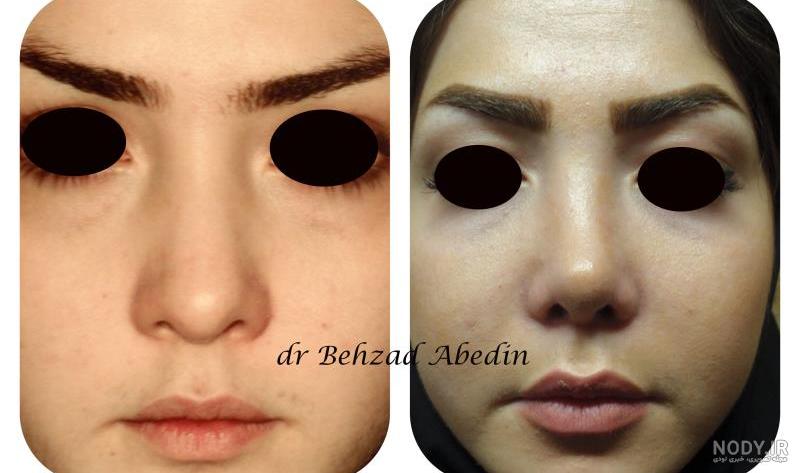 بهزاد عابدینی لات بهزاد عابدینی لات