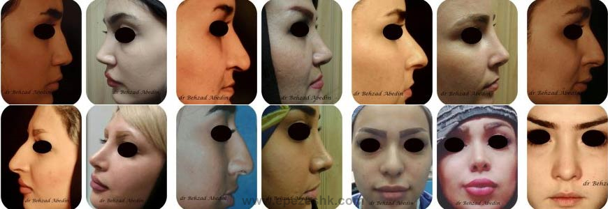 شماره مطب دکتر بهزاد عابدین شماره مطب دکتر بهزاد عابدین