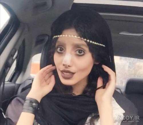 عکس سحر تبر قبل از عمل عکس سحر تبر قبل از عمل