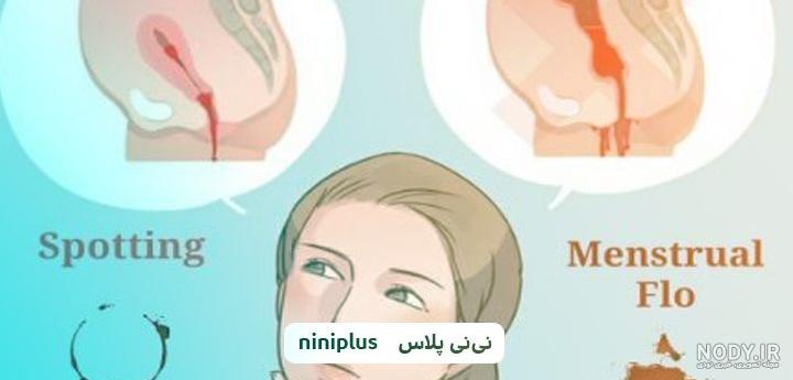 کیا لکه بینی قهوه ای داشتن و باردار بودن کیا لکه بینی قهوه ای داشتن و باردار بودن