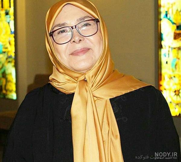 آفرین عبیسی قبل از عمل بینی