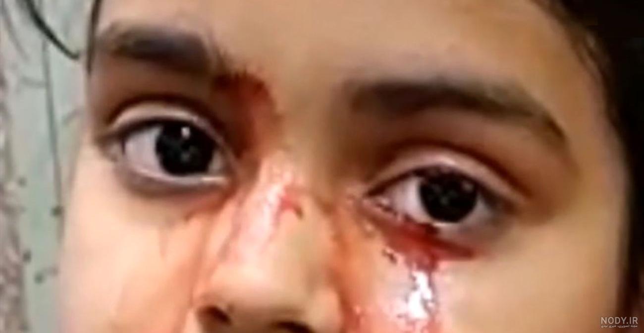 عکس چشم گریون پسر