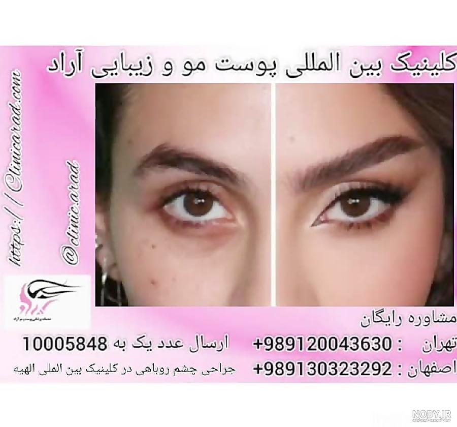 اموزش انواع خط چشم
