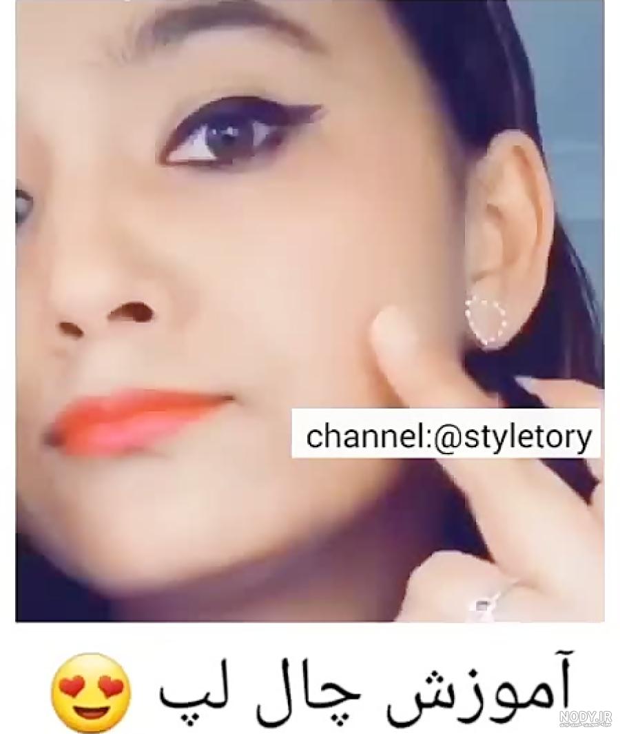 انواع چال گونه