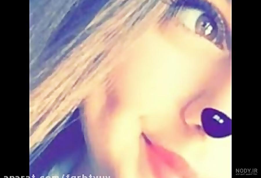 ایجاد چال گونه با نخ در خانه