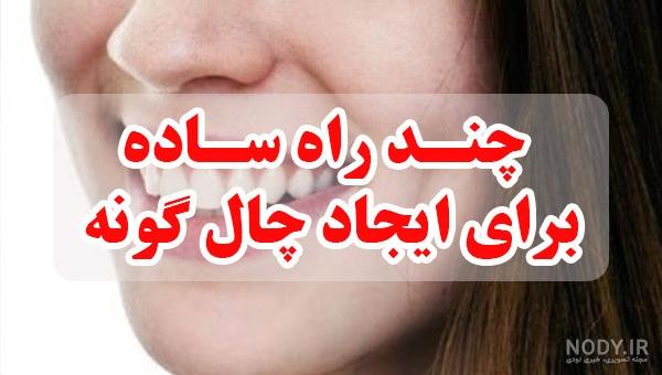 عکس تبریک روز چال گونه