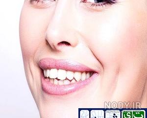 عکس دختر بچه چال گونه دار