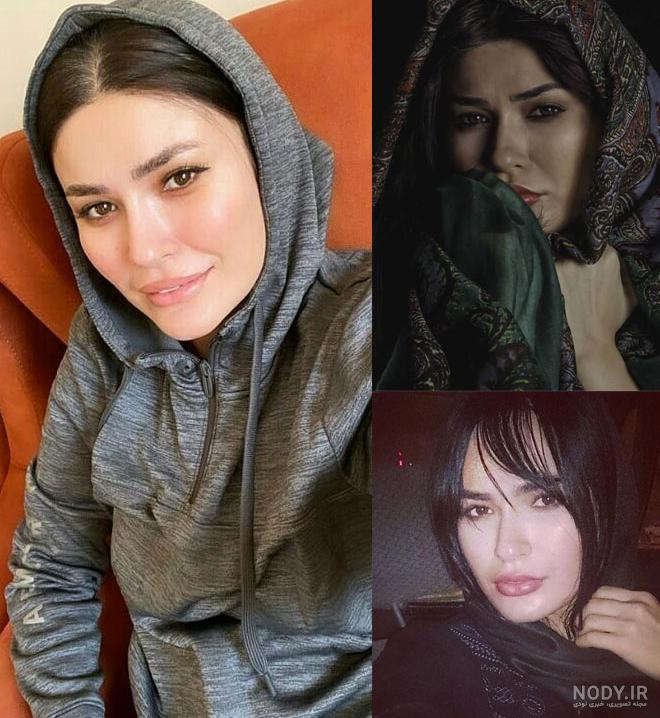 عکس شیوا طاهری قبل از عمل