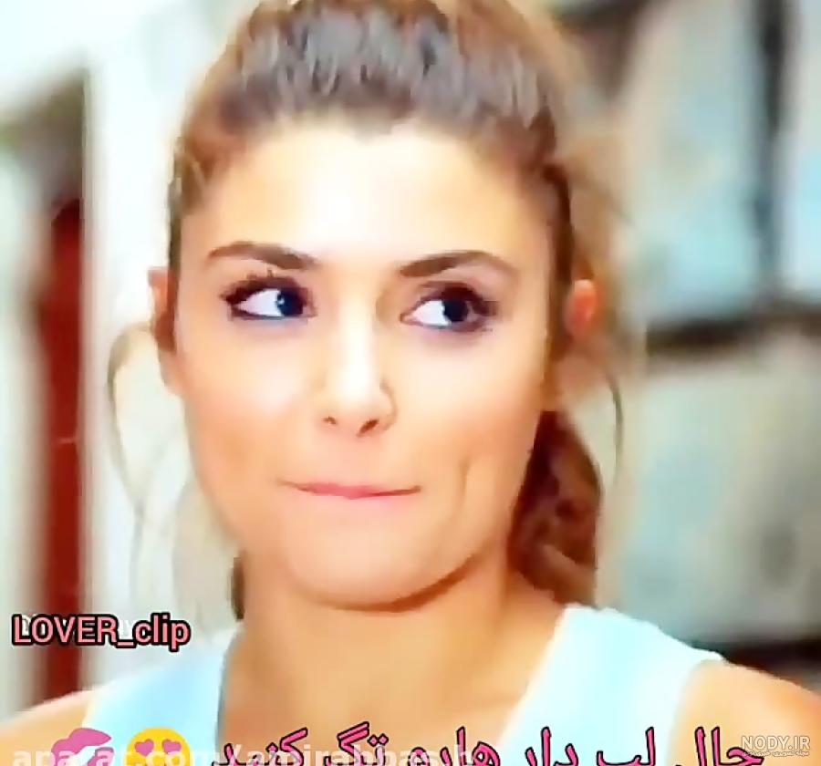 عکس چال گونه بچه