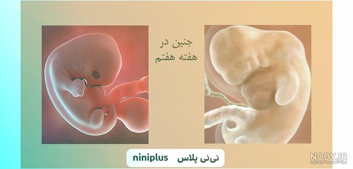 عکس کودک در شکم مادر