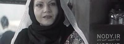 عکسهای مژگان کچل