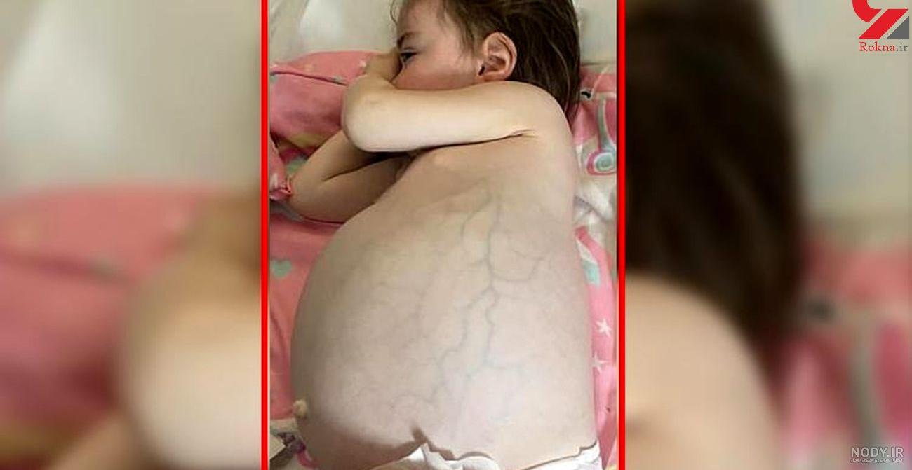 دختر 12 ساله ای که با اینترنت باردار شد