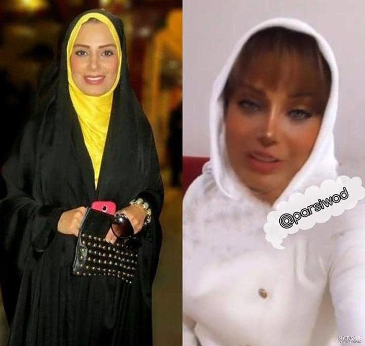 صبا راد قبل از عمل