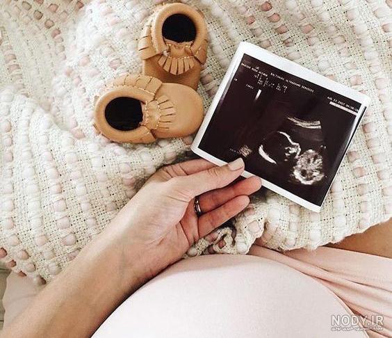 عکس بینوایان واقعی